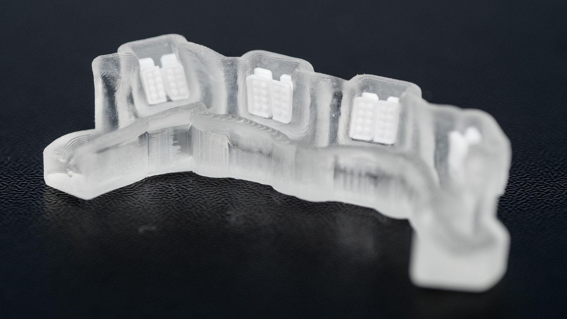 3-D printed braces