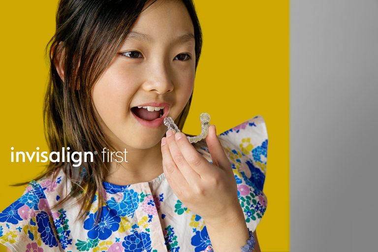 Invisalign First - Yang Orthodontics