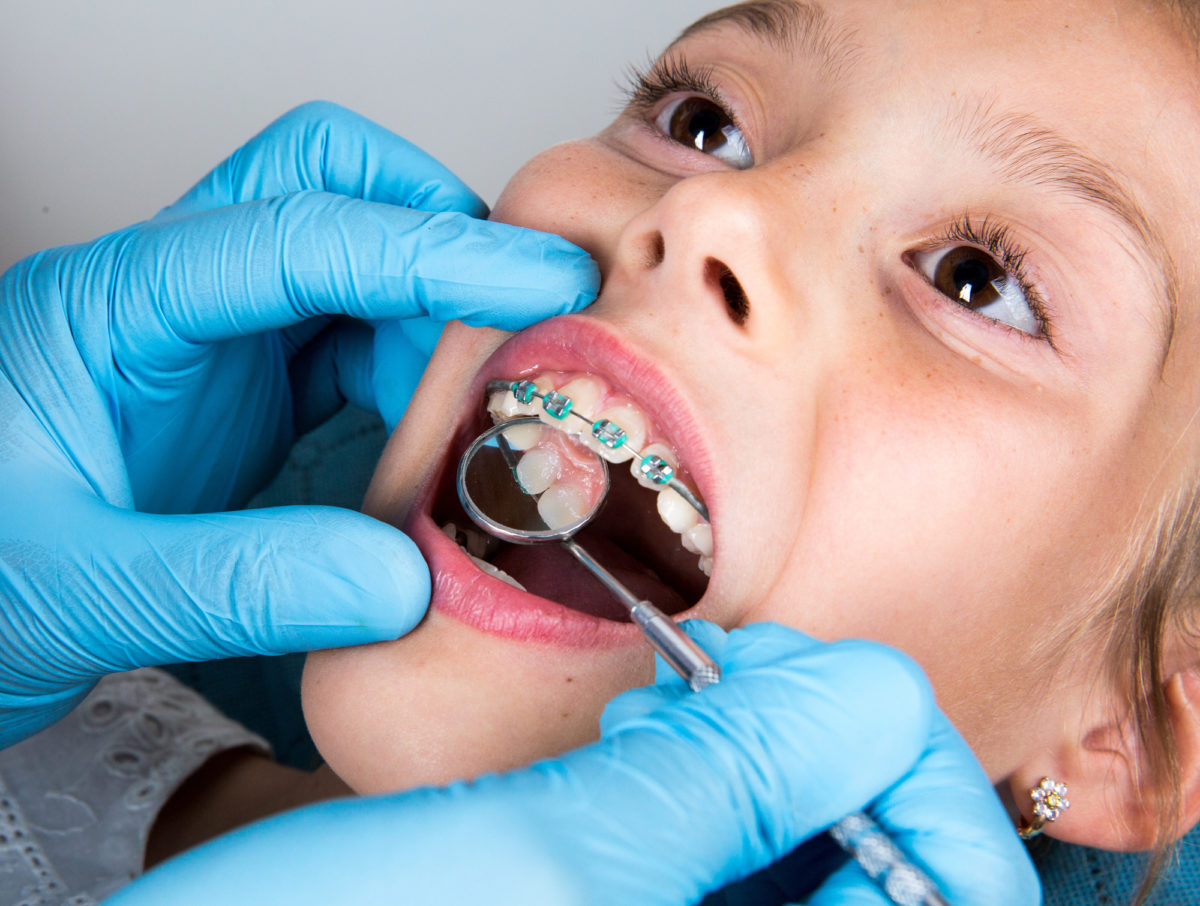 Everything About Orthodontic Treatment: Improving Your Child'S