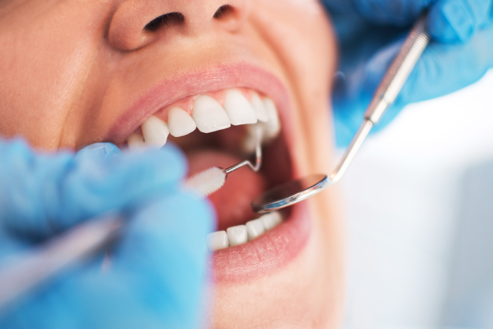 Orthodontics and Oral Health: The Link Between Straight Teeth and Overall  Wellness - Yang Orthodontics