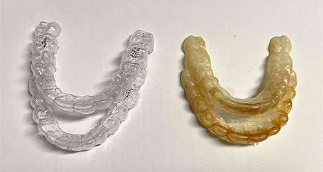 Clean versus dirty retainers. Yellow and cloudy and full of plaque replace your retainer when needed.