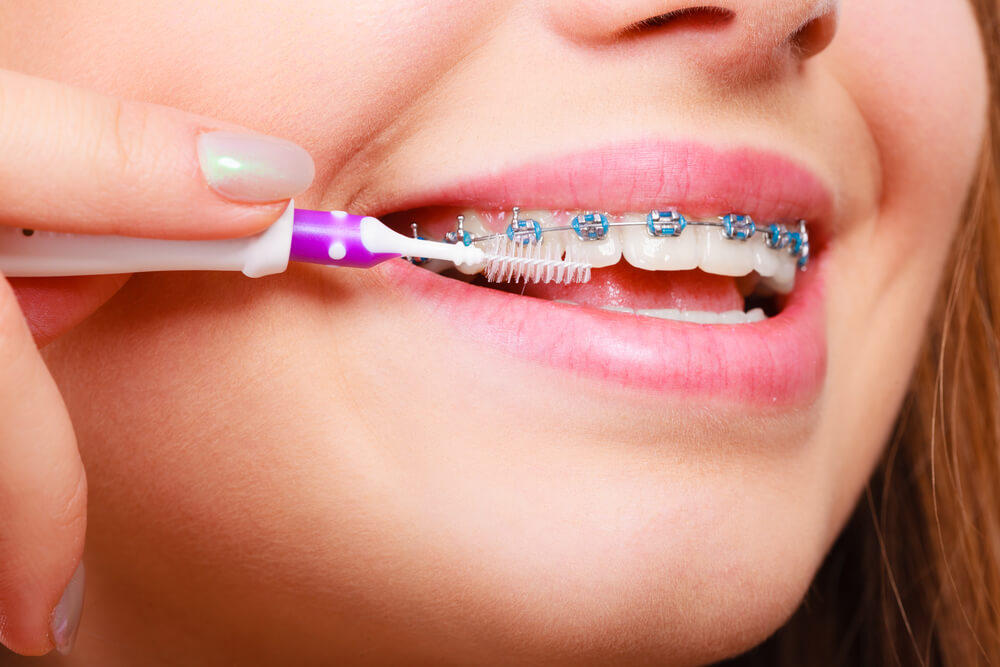 How To Deal With Orthodontic Emergencies Yang Orthodontics 