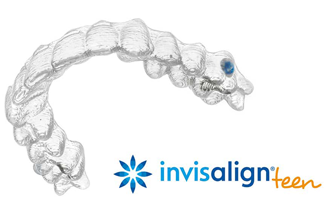 Orthodontic appliance known as Invisalign Teen clear aligners.