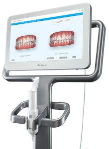 An iTero scanner showing a digitized before and after of a patient's teeth.
