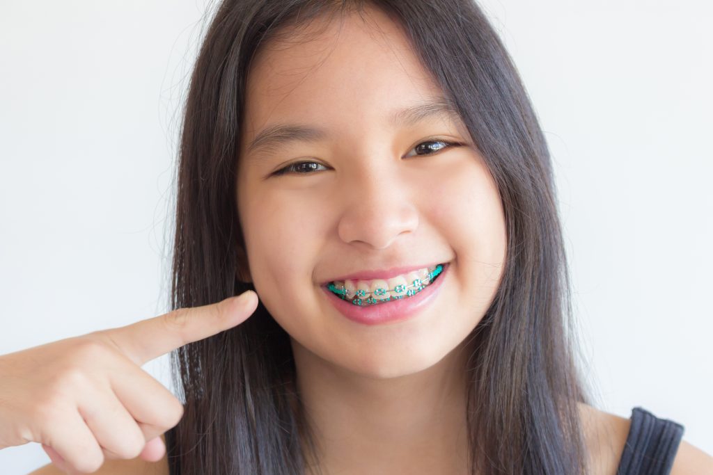 Child with braces pointing at her mouth.
