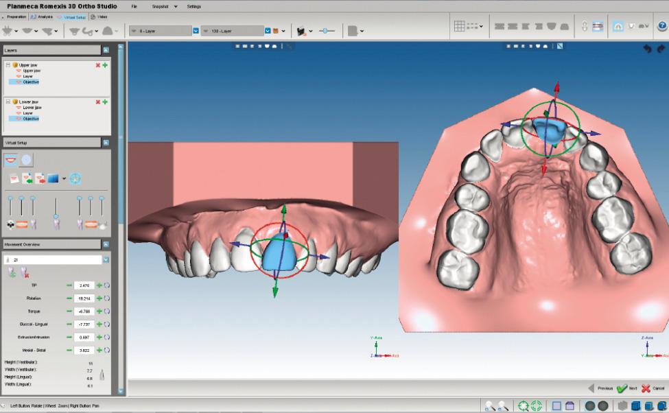 3-d tooth mold creator