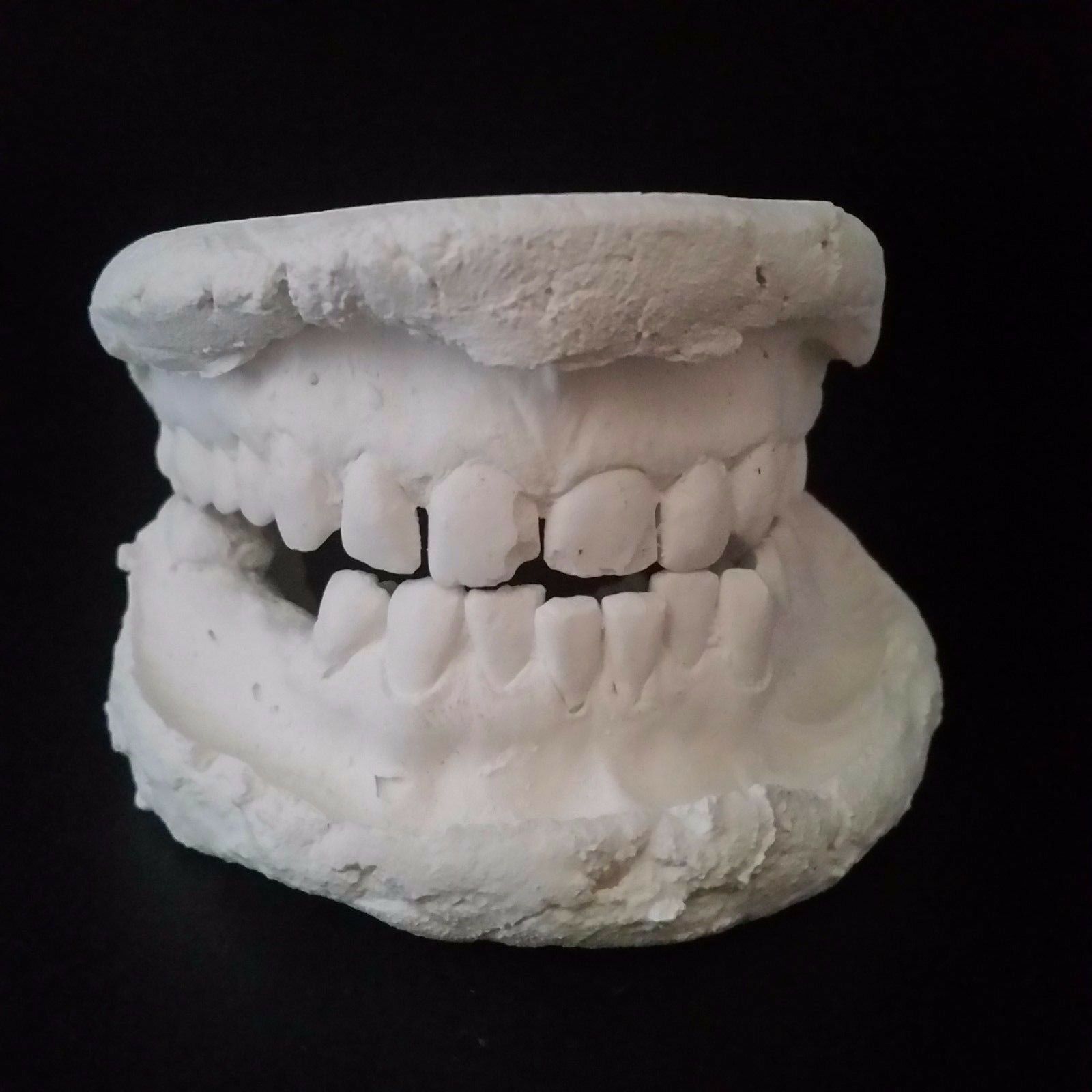 tooth mold