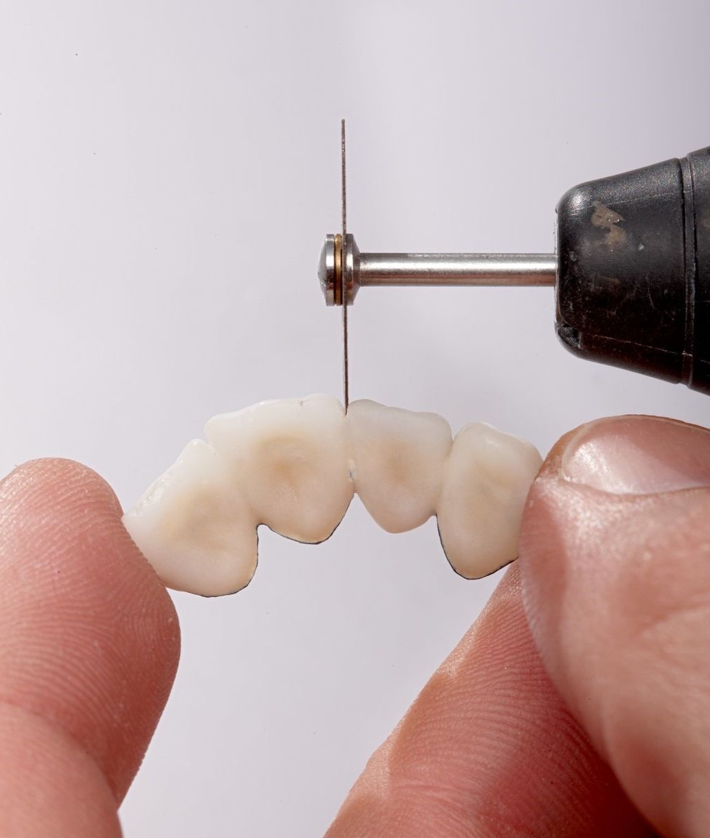 orthodontic saw cutting through mold